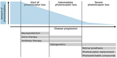 Rebuilding the Missing Part—A Review on Photoreceptor Transplantation